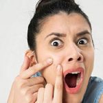 ঘাড়ের কালো দাগ দূর করতে এই কাজগুলো করুন