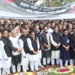 ১৩ ঘন্টার অপারেশনে দুই শিশুর জোড়া মাথা আলাদা হলো