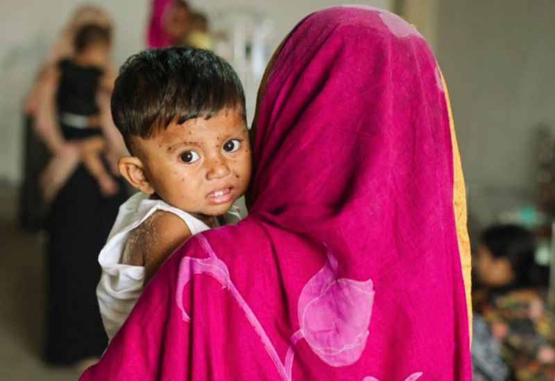হাম ও উপসর্গ নিয়ে ২৪ ঘণ্টায় আরও ১৭ প্রাণহানি, আক্রান্ত হাজারো শিশু